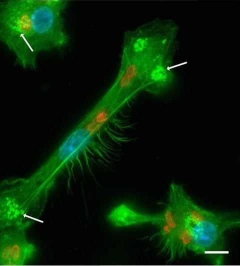 Fluorescence micrograph of a dendritic cell infected with Toxoplasma parasites lacking TgWIP: F-actin in green, nucleus in blue, parasites in red.
