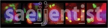 Saeijentist, spelled out in fluorescence micrographs of Toxoplasma-infected cells